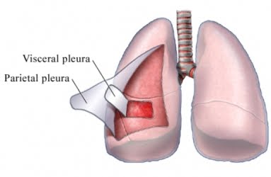 Osler-Weber-Rendu Disease and Pulmonary Arteriovenous Fistulas (3)